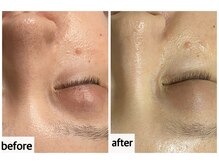 メナードフェイシャルサロン 岐阜茜部/しわケア/たるみケア/毛穴