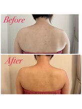 ユーブルーム(youbloom)/美ボディーライン★背中の変化★