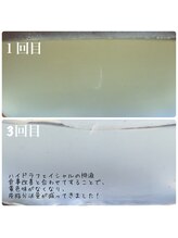 ハレハダ(HAREHADA)/ハイドラフェイシャル×食事改善