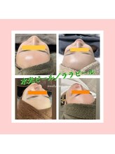 エムアイ 六本木(Mi)/