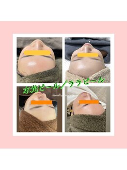 エムアイ 六本木(Mi)/