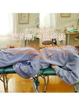 シャロームカイロプラクティックおおば/そり腰【整体/マッサージ/腰痛】