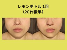 アユアラングレース/レモンボトル1回