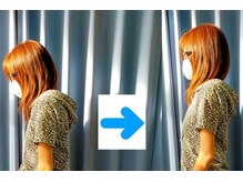 いのくち接骨院/姿勢改善の症例