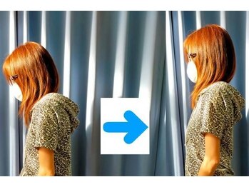 いのくち接骨院/姿勢改善の症例