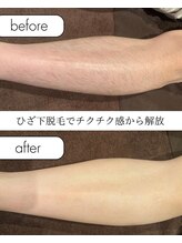 モアトゥインクル 福山神辺店(MORE twinkle)/ひざ下