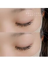 キママニ(kimamani)/上品ボリューム◎バインドロック