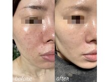 アンベリール(Embellir)