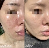 アンベリール(Embellir)