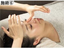 ラプリシュシュ 岡山店(Raplit)/施術6 鼻の矯正 鼻筋/曲がり矯正