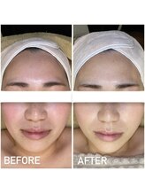 エステプリヴェモロッコ(ESTHE PRIVE MOROCCO)/ILLUSTRIOUS 【赤み・色ムラ】