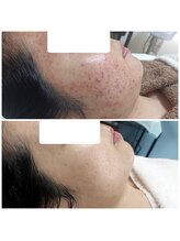 ミュー(Mieux)/家族からの綺麗になったが嬉しい