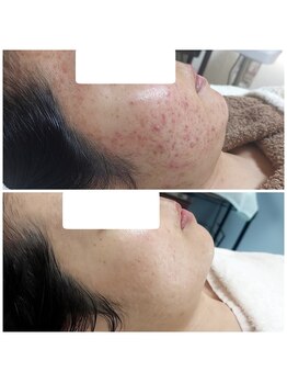 ミュー(Mieux)/家族からの綺麗になったが嬉しい