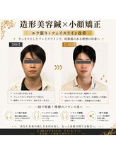 エモシオン トウキョウ(EMOTION TOKYO)/造形美容鍼×小顔矯正