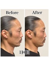 小顔22 ボルティ 本店(Bolty)/お客様