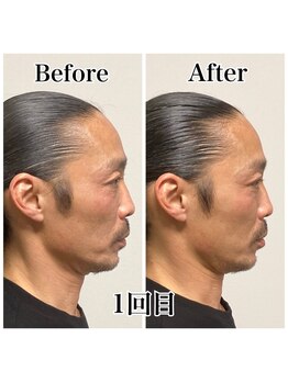 小顔22 ボルティ 本店(Bolty)/お客様