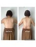 【上半身の印象激変】浮腫みスッキリ背中美人へ♪初回￥16,500