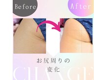 ハウオリ(Hauoli)/お尻の垂れが気になり始めて