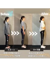 ファウンド 福山蔵王店(FOUND)/姿勢改善