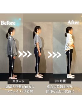 ファウンド 福山蔵王店(FOUND)/姿勢改善