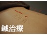 〈鍼〉【不眠・耳鳴り・抜け毛改善】AI姿勢分析×鍼75分￥6,600→初回￥4,950