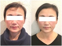 美容整体 ウェリナ 蟹江院/小顔矯正/骨盤矯正/美脚サロン