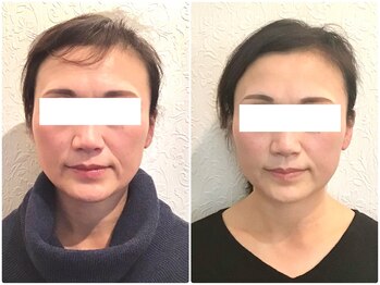 美容整体 ウェリナ 蟹江院/小顔矯正/骨盤矯正/美脚サロン