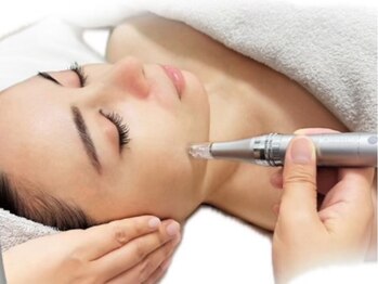 ビューティー モア 長岡店(More)の写真/【エステ版ソフトダーマでシワ改善】嬉しい目元の施術も可能！ダウンタイム無しで若々しい見た目に☆