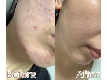 スリリアン 銀座/★お客さまビフォーアフター★