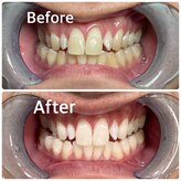 シャイニング 岩出店(SHINING)