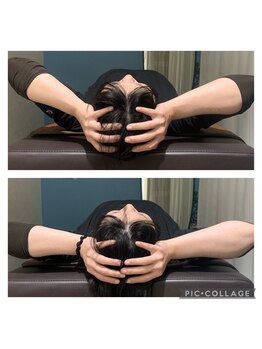 ア ムーン ドロップ(a Moon Drop)/施術前後の印象比較