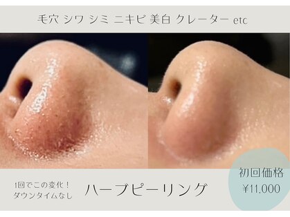 アールエスト(R EST.)の写真