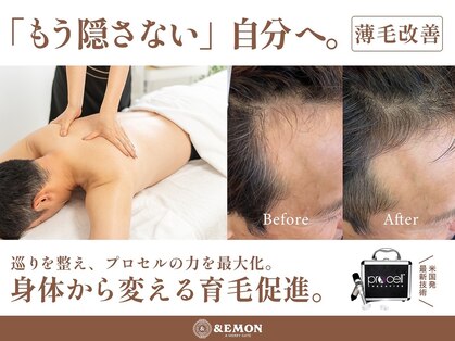 アンドエモン(&EMON)の写真