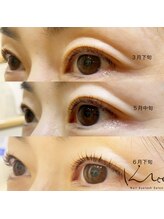 クレー(Klee)/パリジェンヌラッシュリフト