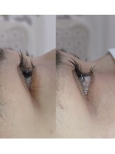 シュウ(shu)/上下ラッシュリフト