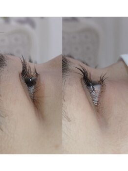 シュウ(shu)/上下ラッシュリフト