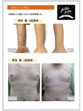 ジョリージョリー(jolie jolie)/参考資料５