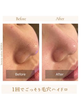 モナ 宝塚店(Mona)/ビフォーアフター