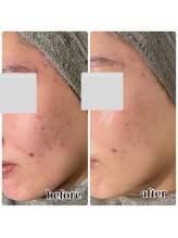 レピア つくば店(LEPIA)/1回ビフォーアフター