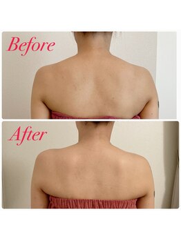 ユーブルーム(youbloom)/美ボディーライン★背中の変化★