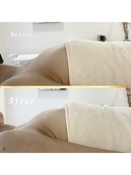 タワワ(TaWaWa)/40代女性　ボリュームでお悩み