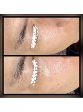 ココスタイルビューティー(COCOSTYLE beauty)/ララピール