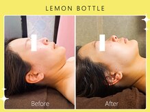 シロカネ イオンタウン西熊本店(SHIROKANE)/小顔コルギ×レモンボトル☆