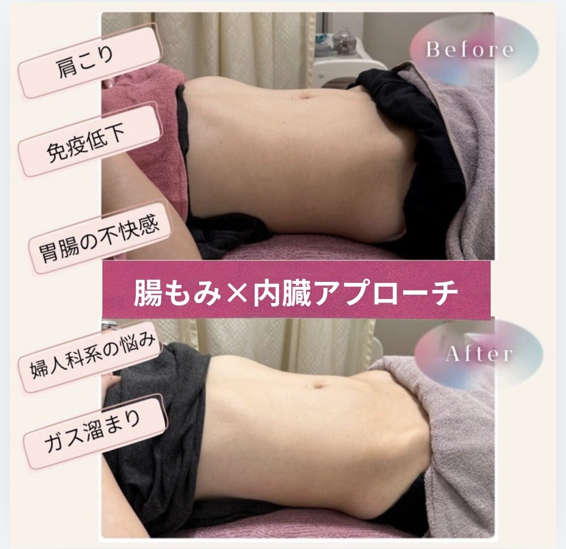 綾瀬駅でキャビテーションが人気のエステサロン｜ホットペッパー