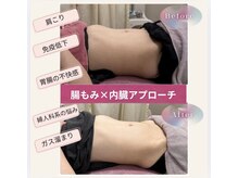 ラクーラビューティー(Lacu-ra Beauty)