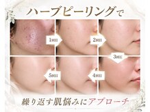 アールイーサロン(Re:salon)