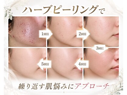 アールイーサロン(Re:salon)の写真