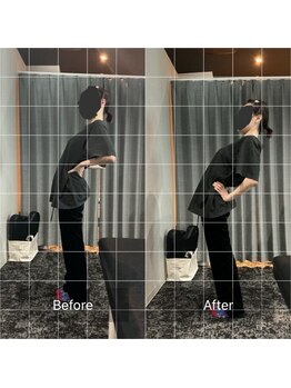 ナオル整体 大阪京橋院(NAORU整体)の写真/【本格整体(AI姿勢診断付)♪】つらい腰の痛みもスッキリ♪お悩みの原因を特定し根本から改善！平日割引有◎