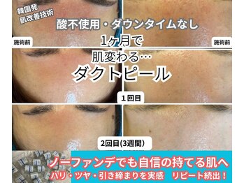 サロン エム(Salon M)の写真/☆結果重視の肌改善☆韓国からの最新アイテム！ダクトピールで集中ケア、毛穴レスの肌に！！本物のツヤ肌を