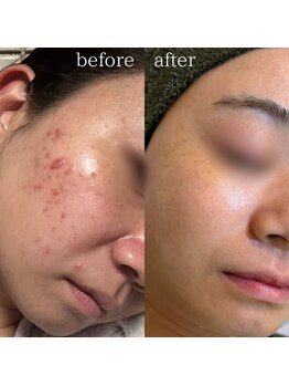エステティックサロン ナチュラーレの写真/【根本からの肌質改善を目指す方に◎】大人女性の肌悩みに寄り添い結果重視のメニューをご提案！